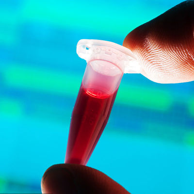 एफडीए स्वीकृत परीक्षण प्रयोगशालाएं रैपिड डिटेक्शन फूड कॉन्टैक्ट बेबी बॉटल थर्ड-पार्टी ऑथेंटिकेशन सर्विस